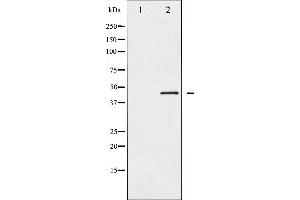Western blot analysis of MEK2 expression in ovarycancer whole cell lysates,The lane on the left is treated with the antigen-specific peptide. (MEK2 Antikörper  (C-Term))