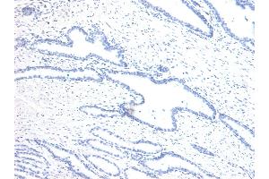 (ABIN6391406) Negative Control showing staining of paraffin embedded Human Prostate, with no primary antibody. (Homeobox D13 Antikörper  (Internal Region))