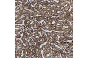 Immunohistochemical staining of human liver with ZNF629 polyclonal antibody  shows strong cytoplasmic positivity in hepatocytes at 1:50-1:200 dilution. (Zinc Finger Protein 629 (ZNF629) Antikörper)