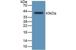 Detection of Recombinant HJV, Human using Monoclonal Antibody to Hemojuvelin (HJV) (HFE2 Antikörper  (AA 29-401))