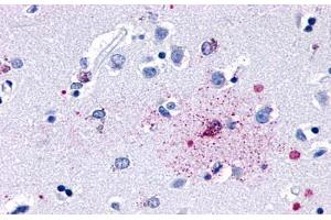 Anti-GPR139 antibody  ABIN1048722 IHC staining of human brain, neurons and glia.