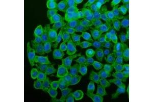 IF analysis of CYP1A1 using anti-CYP1A1 antibody (ABIN3043819).