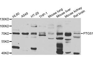 Western blot analysis of extracts of various cell lines, using PTGS1 antibody. (PTGS1 Antikörper)