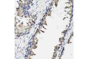 Immunohistochemistry of paraffin-embedded human prostate using OTC antibody.