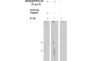Image no. 1 for anti-Arachidonate 5-Lipoxygenase-Activating Protein (ALOX5AP) antibody (ABIN4620366)