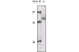 Western blot analysis using RSK1 mouse mAb against truncated RSK1 recombinant protein. (RPS6KA1 Antikörper)