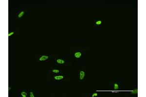 Immunofluorescence of monoclonal antibody to FUSIP1 on HeLa cell. (SRSF10 Antikörper  (AA 1-100))