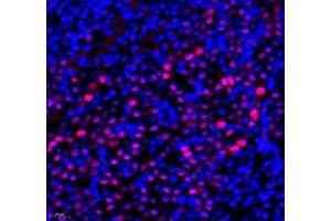 Immunofluorescence of paraffin embedded mouse kidney using Transketolase (ABIN7075978) at dilution of 1: 1100 (400x lens) (TKT Antikörper)