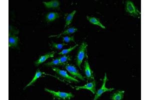 Immunofluorescence (IF) image for anti-Cyclin-Dependent Kinase Inhibitor 2C (p18, Inhibits CDK4) (CDKN2C) (AA 1-68) antibody (ABIN7148889)