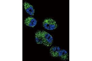 Confocal immunofluorescent analysis of CYP4A11 (4A22) Antibody (C-term) (ABIN392368 and ABIN2842004) with NCI- cell followed by Alexa Fluor 488-conjugated goat anti-rabbit lgG (green). (CYP4A11+22 (AA 407-435), (C-Term) Antikörper)
