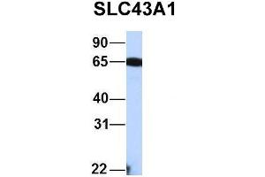 Host:  Rabbit  Target Name:  FAM46C  Sample Type:  Human Fetal Liver  Antibody Dilution:  1. (SLC43A1 Antikörper  (Middle Region))