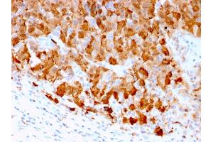 Immunohistochemistry (IHC) image for anti-S100 Calcium Binding Protein A1 (S100A1) antibody (ABIN6940539)