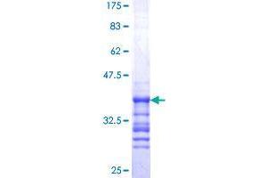SS18L1 Protein (AA 112-200) (GST tag)