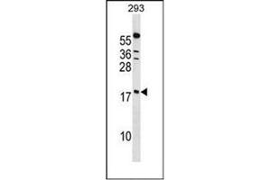 Western blot analysis of PPIL1 Antibody (Center) in 293 cell line lysates (35ug/lane).