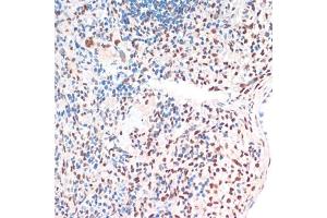 Immunohistochemistry of paraffin-embedded rat spleen using TDP-43/TARDB antibody (ABIN7270731) at dilution of 1:200 (40x lens). (TARDBP Antikörper  (AA 1-260))