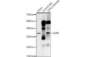 Immunoprecipitation analysis of 300 μg extracts of 293T cells using 3 μg E2F6 antibody (ABIN7266876). (E2F6 Antikörper)