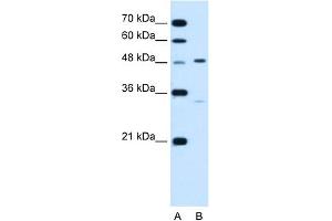 WB Suggested Anti-CHST1 Antibody Titration:  1. (CHST1 Antikörper  (N-Term))