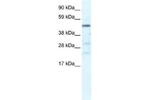 WB Suggested Anti-HSFY1 Antibody Titration:  5. (HSFY1 Antikörper  (N-Term))