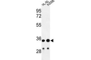 Western Blotting (WB) image for anti-Immunoglobulin Heavy Chain (IgH) antibody (ABIN2995207) (IgH Antikörper)