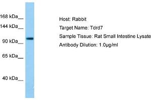 Host: RabbitTarget Name: Tdrd7Antibody Dilution: 1.