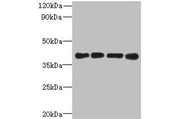 MAGEB18 antibody  (AA 1-270)
