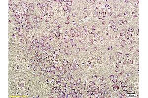 Formalin-fixed and paraffin embedded human cervical tissue labeled with Anti-CNR1 Polyclonal Antibody, Unconjugated (ABIN732923) at 1:200, followed by conjugation to the secondary antibody and DAB staining (CNR1 Antikörper  (AA 401-472))