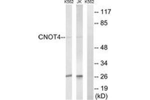 Western blot analysis of extracts from Jurkat/K562 cells, using CNOT4 Antibody. (CNOT4 Antikörper  (AA 61-110))