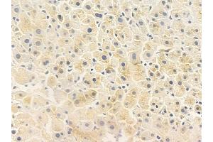 ABIN6260552 and ABIN6272501 at 1/100 staining human normal liver tissue by IHC-P.
