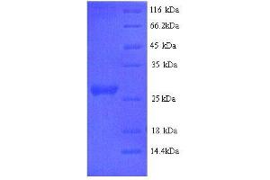 SDS-PAGE (SDS) image for Interleukin 6 (IL6) (AA 27-241), (full length) protein (His tag) (ABIN7479412)