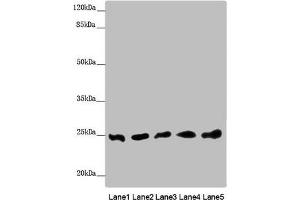 Western blot All lanes: EEF1B2 antibody at 0. (EEF1B2 Antikörper  (AA 1-225))
