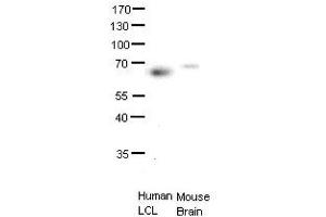 ETS2 antibody - middle region  validated by WB using human LCL and mouse brains at 1:1000. (ETS2 Antikörper  (Middle Region))