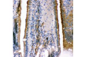 Immunohistochemistry (IHC) image for anti-Potassium Large Conductance Calcium-Activated Channel, Subfamily M, alpha Member 1 (KCNMA1) (AA 124-467) antibody (ABIN3043867)