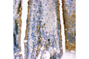 Anti- KCNMA1antibody,IHC(P) IHC(P): Mouse Intestine Tissue