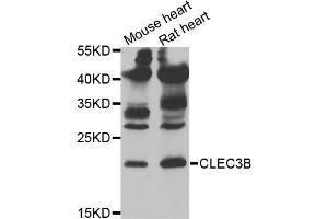Western blot analysis of extracts of various cell lines, using CLEC3B antibody (ABIN5973819) at 1/1000 dilution. (CLEC3B Antikörper)