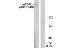 Western blot analysis of extracts from HeLa cells treated with EGF 200ng/ml 30', using mTOR (Phospho-Ser2448) Antibody. (MTOR Antikörper  (pSer2448))