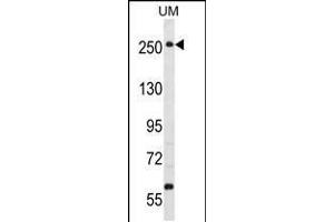 Western blot analysis in uterus tumor cell line lysates (35ug/lane). (WNK3 Antikörper  (C-Term))