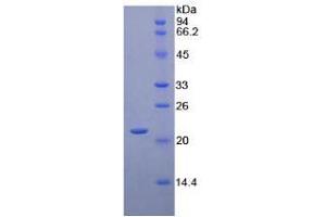 SDS-PAGE analysis of Human CD8b Protein. (CD8B Protein)