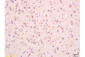 Formalin-fixed and paraffin embedded rat brain tissue labeled with Anti-PCMT1 Polyclonal Antibody, Unconjugated (ABIN715796) at 1:200, followed by conjugation to the secondary antibody and DAB staining