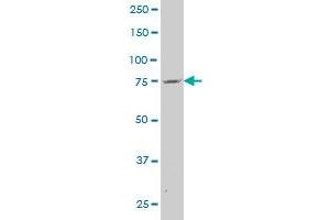 ABCA6 polyclonal antibody (A01), Lot # 060707JCS1 Western Blot analysis of ABCA6 expression in HeLa . (ABCA6 Antikörper  (AA 53-149))