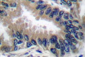 Image no. 1 for anti-Apoptotic Peptidase Activating Factor 1 (APAF1) antibody (ABIN265312) (APAF1 Antikörper)