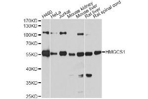 Western blot analysis of extracts of various cell lines, using HMGCS1 antibody (ABIN5972092) at 1:7000 dilution. (HMGCS1 Antikörper)