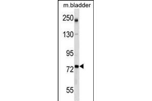GCLC Antibody (Center) (ABIN1538246 and ABIN2849959) western blot analysis in mouse bladder tissue lysates (35 μg/lane). (GCLC Antikörper  (AA 286-315))
