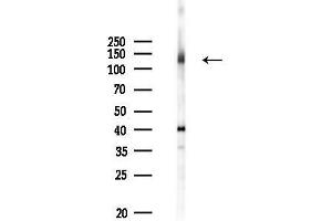 anti-Mitogen-Activated Protein Kinase Kinase Kinase 9 (MAP3K9) (C-Term) antibody