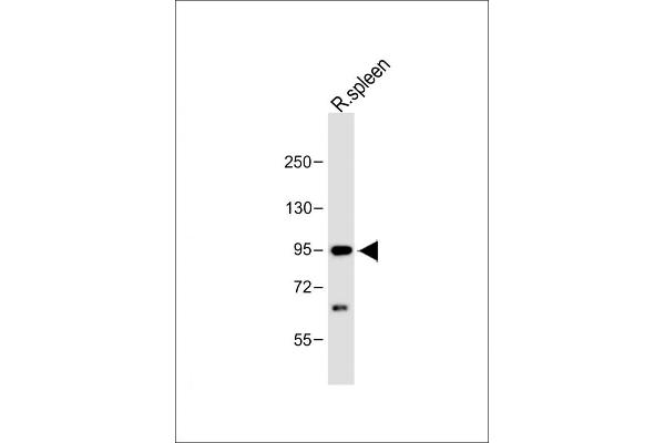 Cbl Proto-Oncogene B, E3 Ubiquitin Protein Ligase (CBLB) (AA 103-130) Antikörper