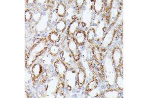 Immunohistochemistry of paraffin-embedded mouse kidney using CDK5R antibody (ABIN7266235) at dilution of 1:100 (40x lens). (CDK5RAP1 Antikörper  (AA 1-350))