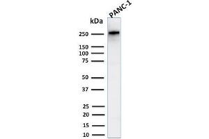 Western Blot Analysis of Human PANC-1 cell lysate using Spectrin beta III Rabbit Recombinant Monoclonal (SPTBN2/2894R). (Rekombinanter Spectrin, Beta, Non-erythrocytic 2 (SPTBN2) (AA 356-475) Antikörper)