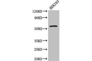 Western Blot Positive WB detected in: HEK293 whole cell lysate All lanes: MLYCD antibody at 2. (MLYCD Antikörper  (AA 40-493))