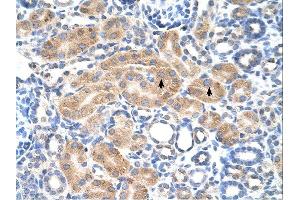 PDE9A antibody was used for immunohistochemistry at a concentration of 4-8 ug/ml. (PDE9A Antikörper  (N-Term))