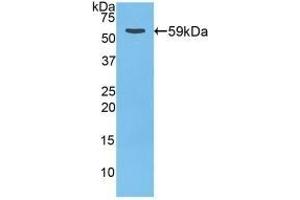 Detection of Recombinant CTSD, Rat using Polyclonal Antibody to Cathepsin D (CTSD) (Cathepsin D Antikörper  (AA 120-407))