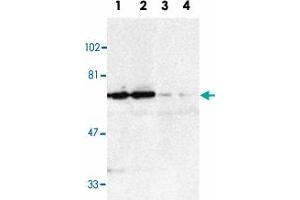 Western blot analysis of TNFRSF21 in K-562 (1, 3) and Raji (2, 4) whole cell lysate in the absence (1, 2) or presence (3, 4) of blocking peptide with TNFRSF21 polyclonal antibody  at 1 : 500 dilution. (TNFRSF21 Antikörper  (AA 42-56))